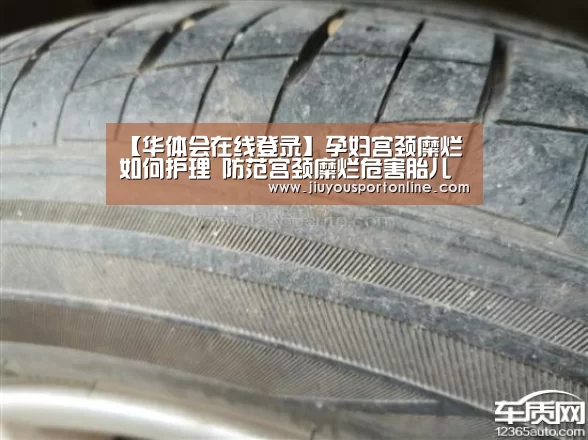 【华体会在线登录】孕妇宫颈糜烂如何护理 防范宫颈糜烂危害胎儿(图2) 【华体会在线登录】孕妇宫颈糜烂如何护理 防范宫颈糜烂危害胎儿(图2)