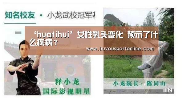 ‘huatihui’女性乳头变化 预示了什么疾病?(图3) 华体会app